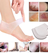 Silicone gel for moisturizing and repairing cracked heels.